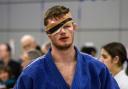 Michael Horley was forced to wear an eye patch after an opponent accidentally poked him in the eye during the British National Judo Championships