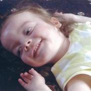 Help needed for Furness tot with rare brain disorder