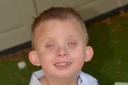 Bobby, who turns five in October, has a genetic condition which causes visual impairment and developmental delay