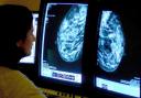 A charity has warned that 12,000 women could be living with breast cancer due to a lack of screenings since the pandemic started (Rui Vieira/PA)