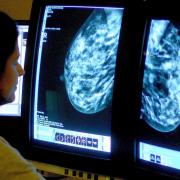 A charity has warned that 12,000 women could be living with breast cancer due to a lack of screenings since the pandemic started (Rui Vieira/PA)